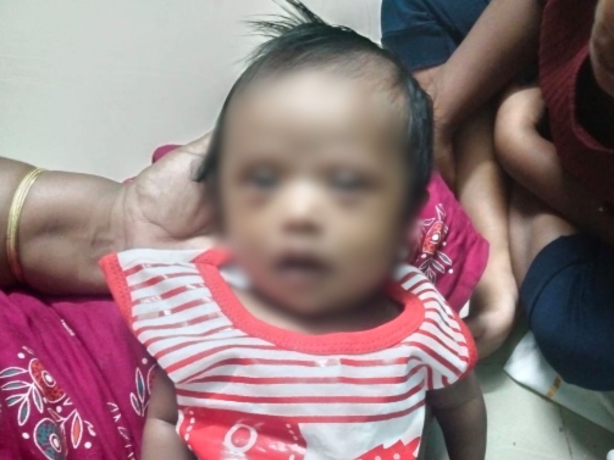Baby Miracline Riana Urgently Needs Early Heart Surgery Following Complete AVSD Diagnosis